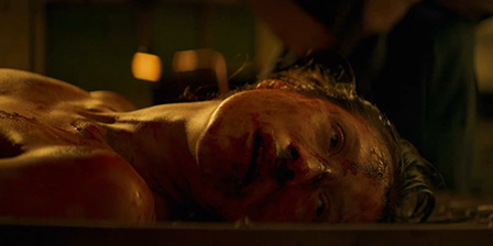 Raped after electro torture